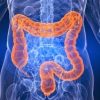 Foods That Can Harm Your Colon: A Closer Look