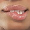 Natural Remedies for Mouth Ulcers and Lip Sores