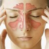 Sinus Infection (Sinusitis): Natural Remedies and Rose Oil